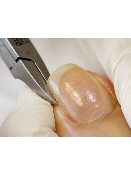 爪の悩みを解消できる（ケア含む）