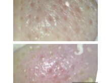 カシェート(cachette)/閲覧注意