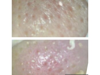 カシェート(cachette)/閲覧注意