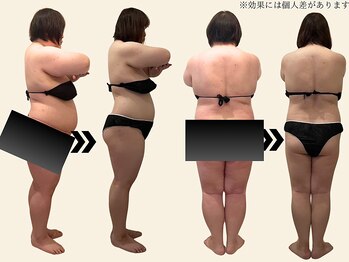 エルソル(elsol)/過食が止められない方も