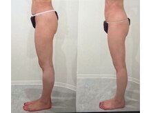 エレニア 住吉店(Elenear)/よもぎ蒸し×リンパマッサージ