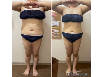 エアリアル 八代店/エアリアルメソッド