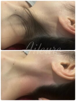 エルール トータルビューティ(Aileure total beauty)/うなじ美人