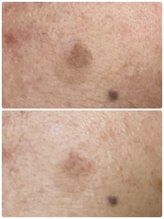 ギャラクシービューティー(galaxy beauty)/