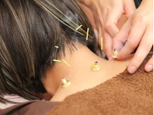 首肩こりを根本改善