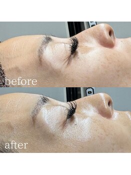 エメリーヌ(AIMELINE)/クリスティーナ フォーエバー