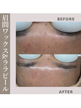 ジーンバイピエル 中野店(gene by PIEL)/#清潔感は肌から！/部分ワックス