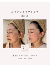 サロンドコーデ(salon de co-de)/エイジングリフトケア
