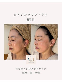 サロンドコーデ(salon de co-de)/エイジングリフトケア