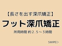 ブルームーンネイルズ(BLOOMOON.nails)/フット深爪矯正