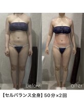 アーネスト 江坂店(EARNEST)/セルライトも浮腫みも同時に対処