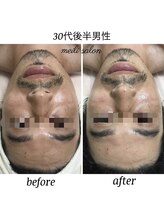 メイリー(MEILI)/男性もモテエステ