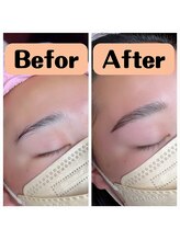 ビーコネクシヨン(美 connection)/HBL☆Befor→After