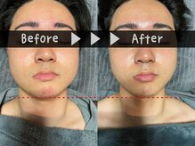 ブラックスワン(Black Swan)/【脱マスク】　イケメン小顔