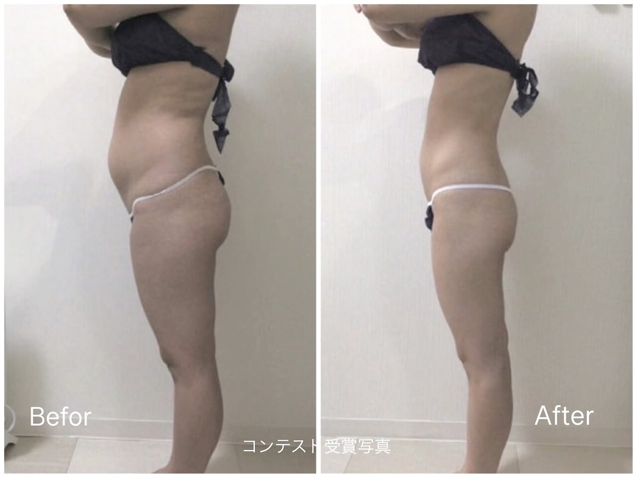 大田原市でエンダモロジーが人気のエステサロン｜ホットペッパー
