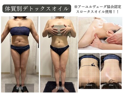 ラペ(la paix)の写真
