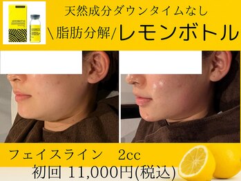美々庵/レモンボトル/小顔/ブライダル
