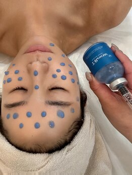 美白ケアをしたい