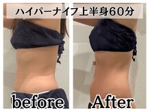 イデアルボーテ/ハイパーナイフでぺたんこに！