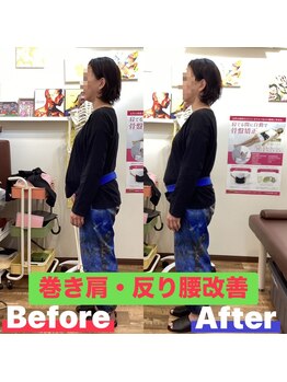 ヒデ整体院(Hide整体院)/猫背矯正骨盤矯正B/A肩こり腰痛