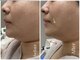 リッチベル(richbelle)の写真