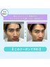 《新規/学割U24/人気No3》美眉WAX+毛量調整(間引き/カット)×選択フェイスWAX