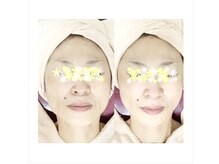 メディカルサロン かとれあ/お客様