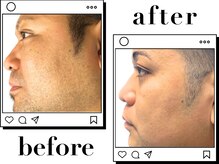 ホワイト(WHITE)/□Before～After〈顔〉