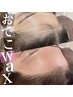 【おでこWAX】最新メニュー！顔脱毛でつるつる卵肌に☆(1回）¥2200