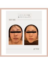 ラウレア(Laure'a)/ハイパーナイフEX／シェイプ