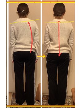 エルトラスト 福井/肩の傾きや猫背、背中の張りに