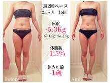 ベルタ 仙台店(BELTA)/【ケア前→後】2ヶ月で-5.3キロ