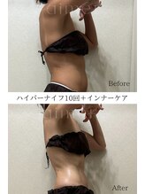 エメ(aimer) 痩身&小顔 最新型導入