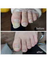 爪切り屋 足楽/切れない爪のケアもお任せ♪