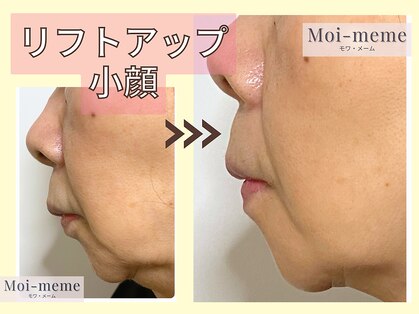 モワメーム(Moi-meme)の写真