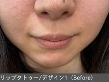 オアシスラグーン(OASIS LAGOON)/リップデザイン1（before）