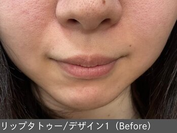 オアシスラグーン(OASIS LAGOON)/リップデザイン1(before)