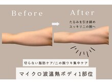インナーグロウ 中目黒(INNER GLOW)の雰囲気（【マイクロ波温熱ボディ】気になる二の腕や脇肉の引き締めにも♪）