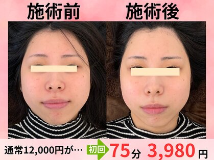 小顔美肌ファクトリー 金沢院の写真