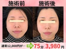 小顔美肌ファクトリー 金沢院