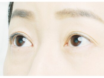 チャンプ 瓢箪山店(Champ)/before→