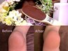 【クイックメニュー】フットケア(かかと角質ケア＋膝下リンパ) 30分※U24対象