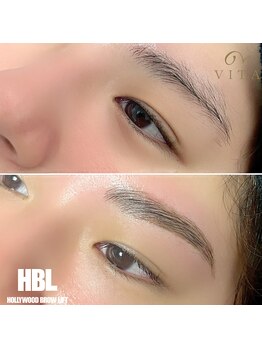 ヴィータ(VITA)/ハリウッドブロウリフト