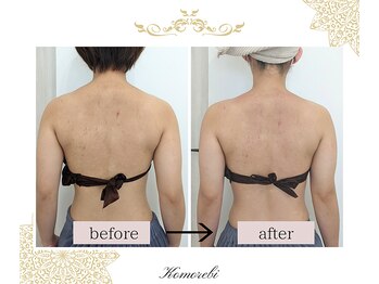 コモレビ(Komorebi)/