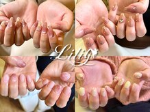 リリー(Liliy)