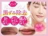 【ローマピンク無料カウンセリング】話題のメラニン除去で赤ちゃんピンク肌☆