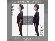 ソフィアパレス/DNAダイエットの結果ケースNo1