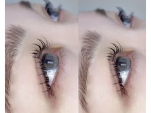 ララ(RARA)/アンドヘルシー100本