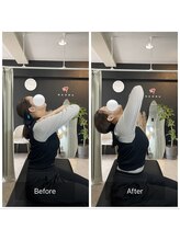 ナオル整体 広島福山院(NAORU整体)/猫背/巻き肩→Before/After