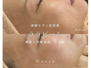 ナッセ(Nasse)/ララピール正規導入店☆